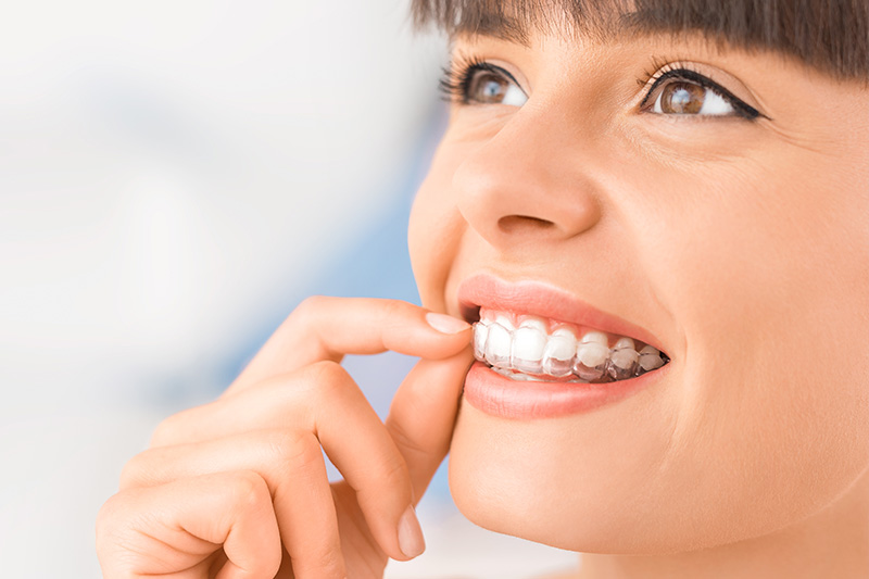 Invisalign in Yorktown Heights