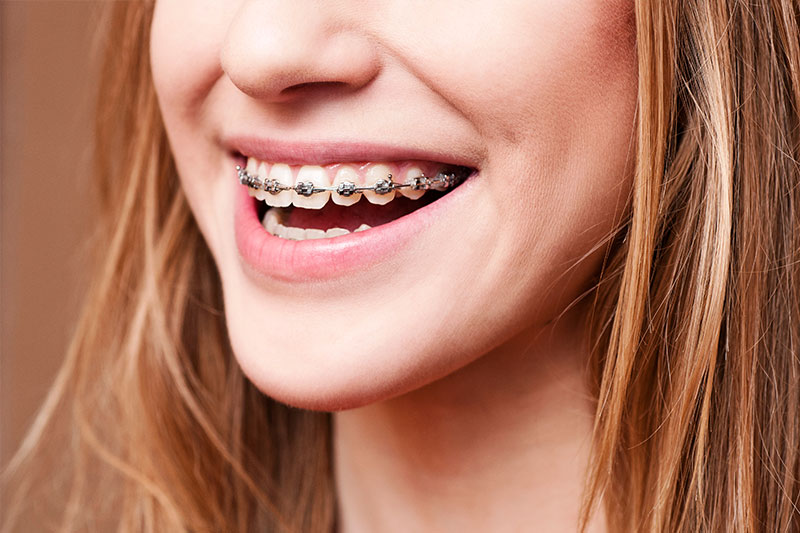 Orthodontics in Yorktown Heights